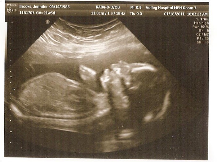 Our baby girl at 21 weeks