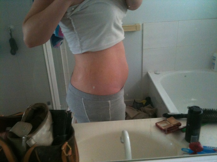 6 weeks pregnant. all bloat <3