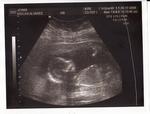 Our baby at 17 wks