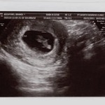 Sono of baby #5 at 8 wks!!