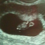 7 weeks ultrasound