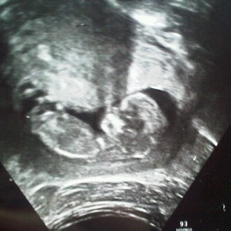 Our little baby Star x x