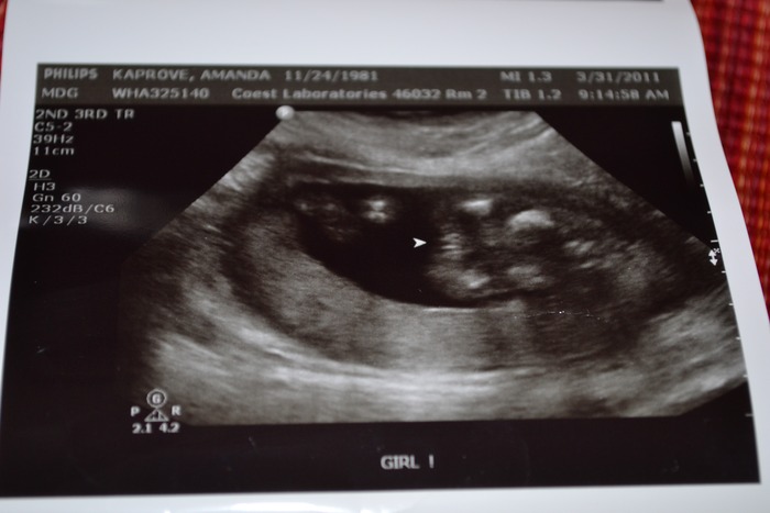 ITS A GIRL!!