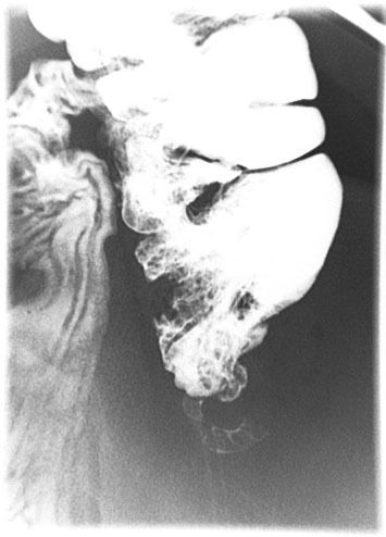 appendix X-ray 05