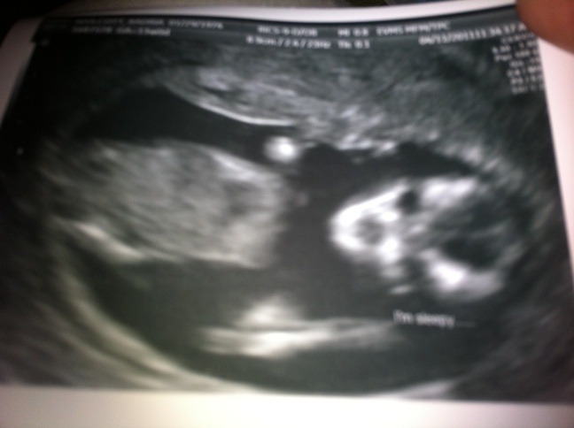 13 weeks 2 days - My little alien :-)