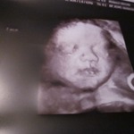 Our beautiful baby girl 30 wks 4-4-11