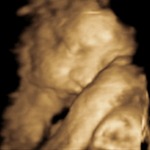 Finally PICS of the new one! I've had multiple elective ultrasounds and he just wouldn't work w/ us.