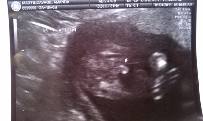 Its a Boy! 18 weeks