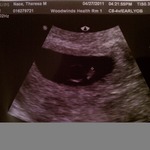 First Picture :) 6w 0d, baby measured 5w 6d