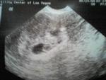 and after my last scare...Perfect Baby! HB 115 BPM 6 weeks 5 days