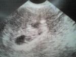 a little closer, it says heartbeat with an arrow. we call it our little dinosaur