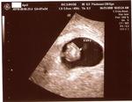 First Ultrasound- 7 weeks 3 days