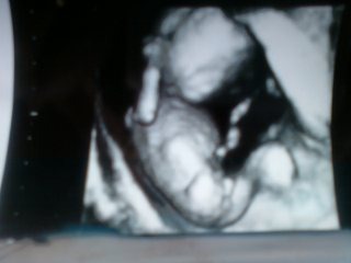 a 3D ultrasound of my little man
