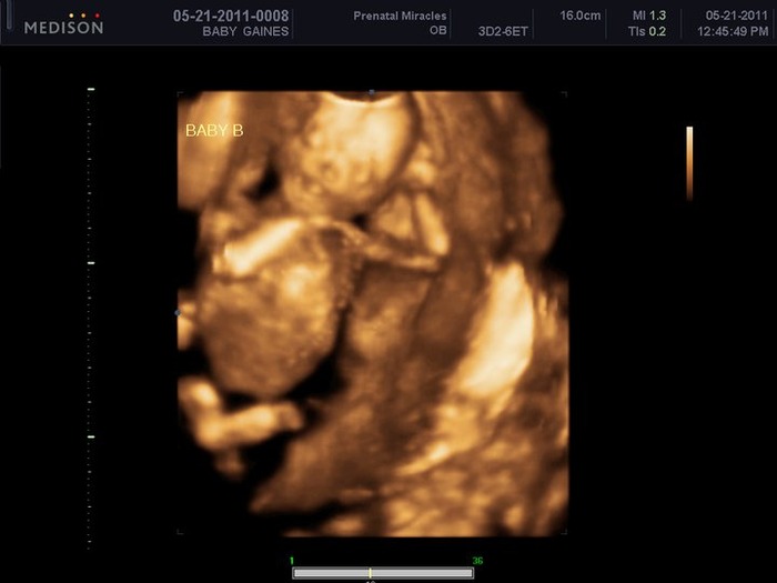 Baby girl isn't camera shy! Hand behind her head and her legs are crossed