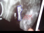 the babies arm like he is waving