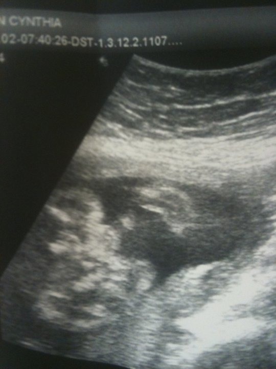 the confirmed ultrasound lol :)
