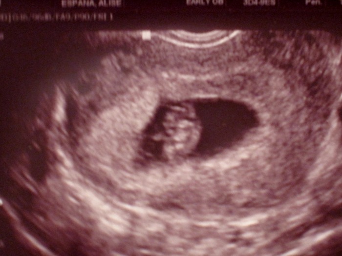 Ultrasound at 7 weeks 2 days