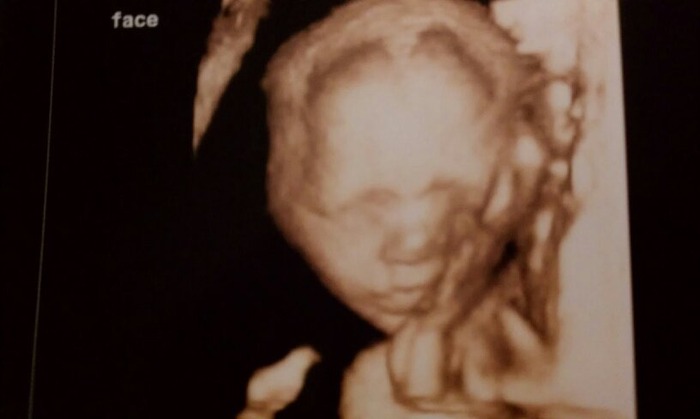 22 weeks 4D ultrasound
