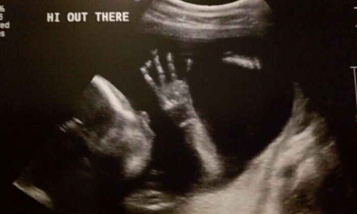22 weeks - look at those LONG fingers ! 