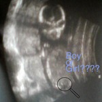 16 week Ultrasound Front View, Boy or Girl?
