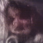 Christian 32week Ultrasound! Chubby cheeks and yes he keeps his hand under his chin still!