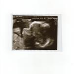 Baby A @ 21 weeks