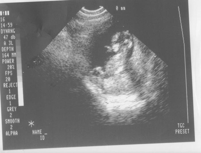 13wks 2 days and can see eyes,nose,mouth, and of curse sucking thumb