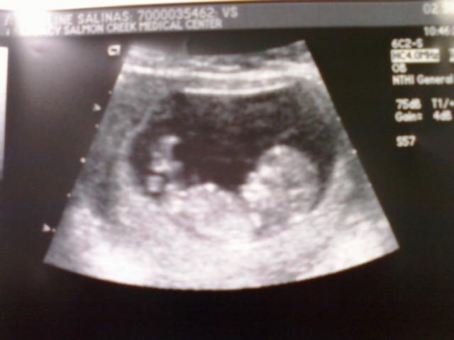 Babys first pic  11wks 4 days
