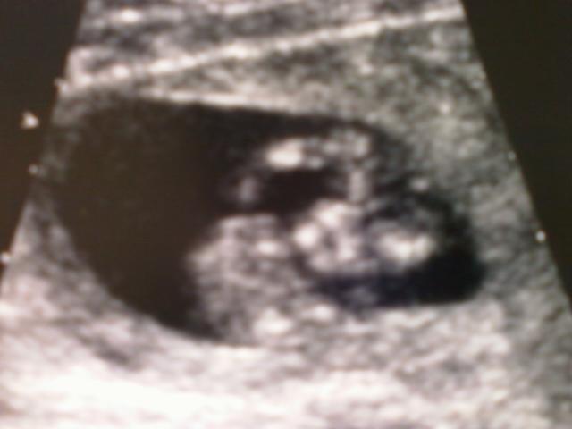 Looking down at babys face 11wks 4 days