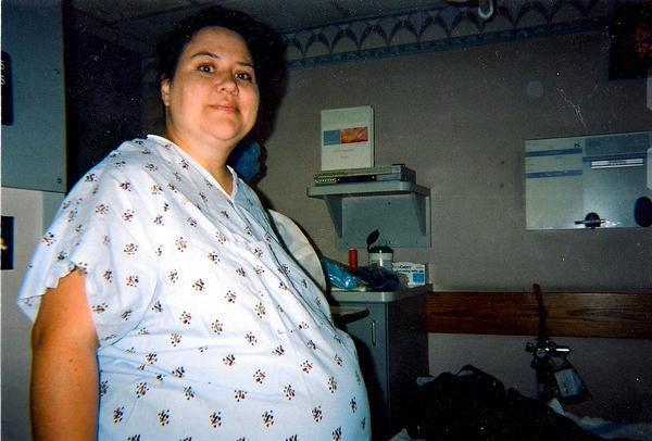 before my c section