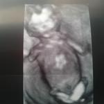 Baby girl 14 weeks 4 days 