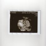 4D pics of baby A