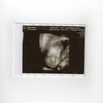 4D Pics of Baby B