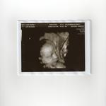 4D Pics of Baby B