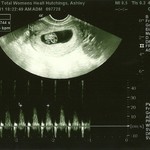 161bpm. This is our little miracle!