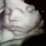 my Chubby lil man at 32 weeks :)