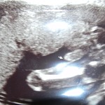 baby#3 is a boy! (sorry, scanner is MIA)