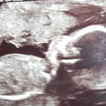 baby #3 - my beautiful boy (sorry no scanner!