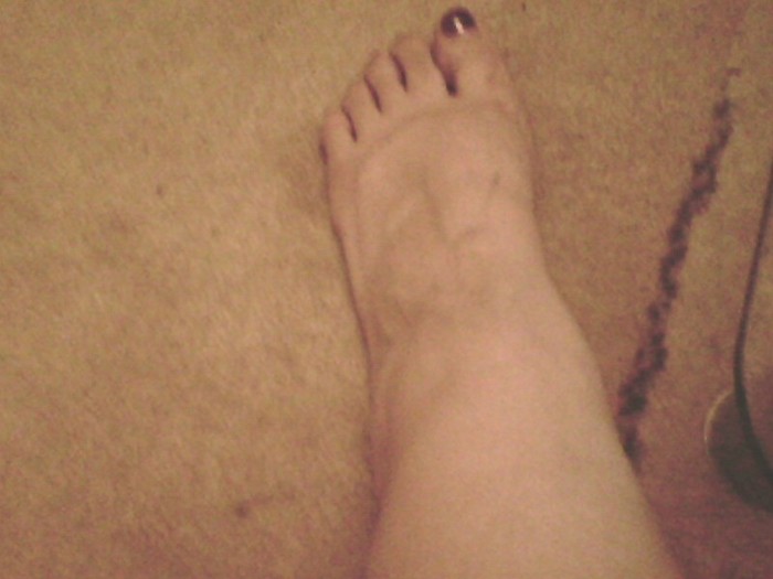 My poor Ankles, the reason i finished work at 30 weeks!!