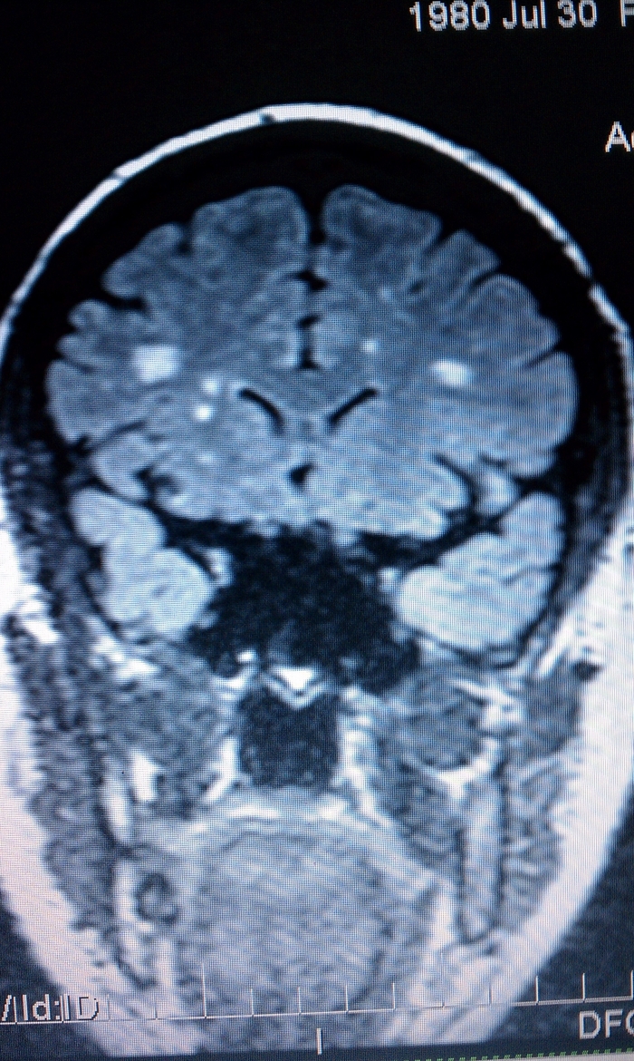 #1  MRI (Sept 2011) 1.5T 