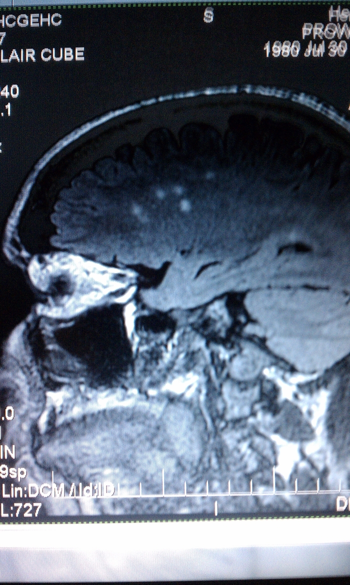 #2 MRI (Sept 2011) 1.5T