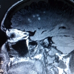 #2 MRI (Sept 2011) 1.5T