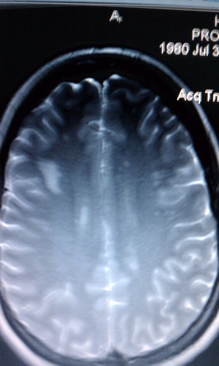 #3 MRI (Sept 2011) 1.5 T
