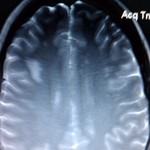 #3 MRI (Sept 2011) 1.5 T