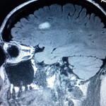 #4 MRI (Sept 2011) 1.5T
