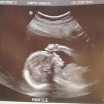It's a Girl! at 20 weeks :)