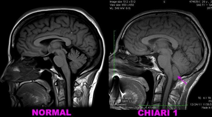 my scan on the right