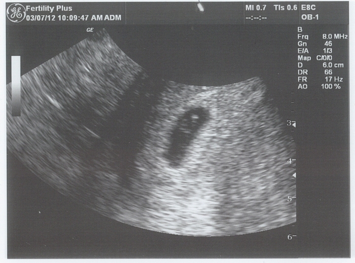6 weeks exactly - we saw the heartbeat!