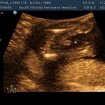 It's a boy!!