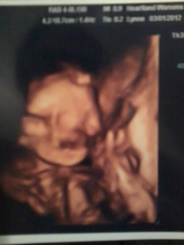 3D of my babys face